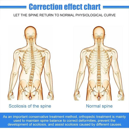 Fixed Aluminium Spinal Brace